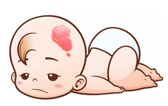 <strong>南京治疗胎记：宝宝头上红色胎记，正常现象还是健康隐患？</strong>