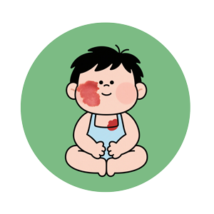 <strong>[南京胎记推荐医院]鲜红斑痣是怎么引起的？</strong>