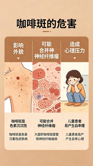 南京胎记医生哪里好点：咖啡斑的发病部位